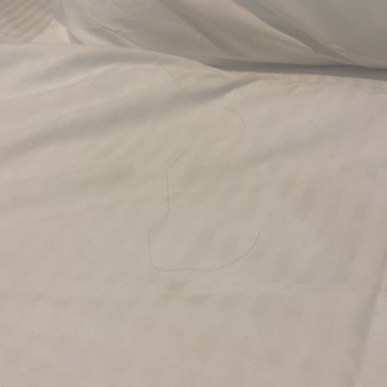Oda Ve Ortak Alanlarda Hijyen Sorunu
