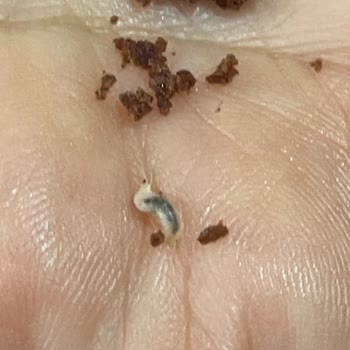 Kakaolu Kekte Kurtçuk Bulunması Ve Gıda Güvenliği Endişesi