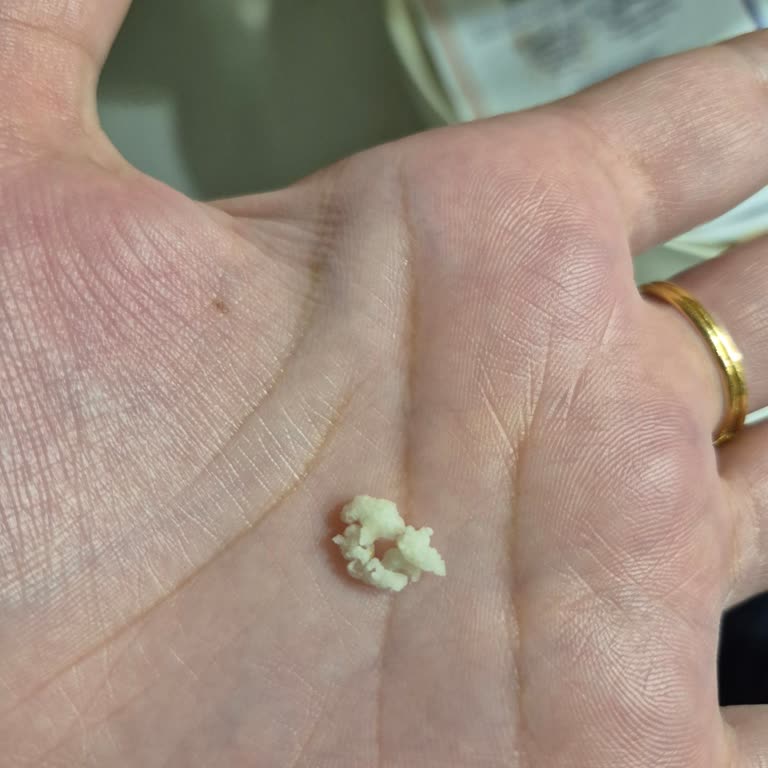 Metro Market’te Dondurulmuş Mısırda Yabancı Plastik Parça Çıktı