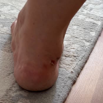 Ayakkabının Tasarım Hatası Derin Yara Açtı, Ücret İadesi Talep Ediliyor