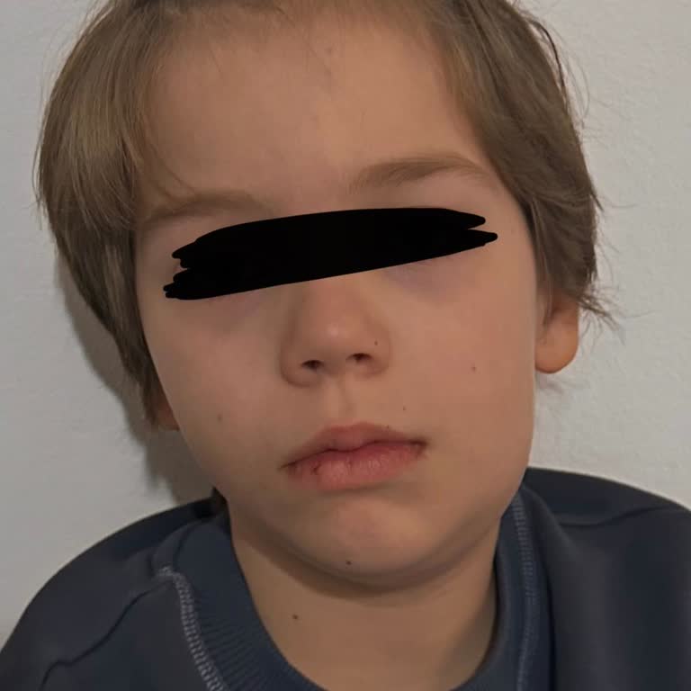 Dolgudan Sonra Çocuğumun Şiddetli Enfeksiyonu Ve Hastanede Beş Gün Kalması