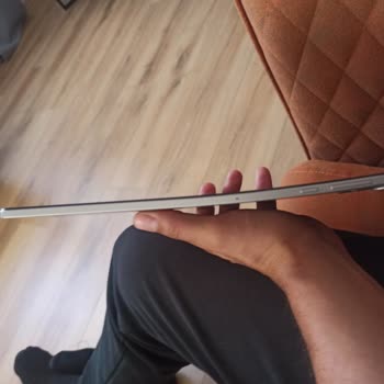Honor Tablet Kendi Kendine Eğildi, Garanti Reddi Ve 10.600 TL Ücretli Onarım Talebi