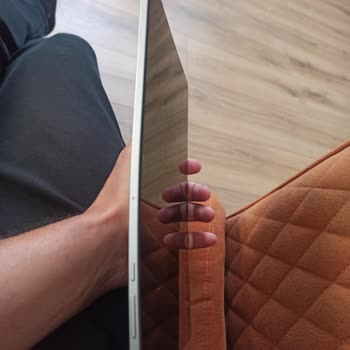 Honor Tablet Kendi Kendine Eğildi, Garanti Reddi Ve 10.600 TL Ücretli Onarım Talebi