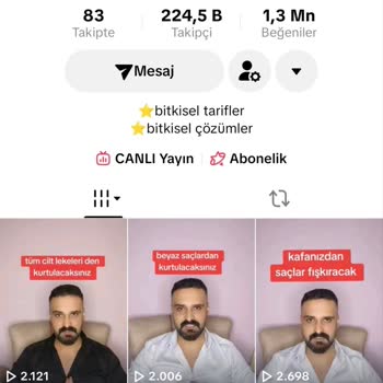 860 TL Ödeme Yaptım, Ürün Hiç Gelmedi, İade Talebi