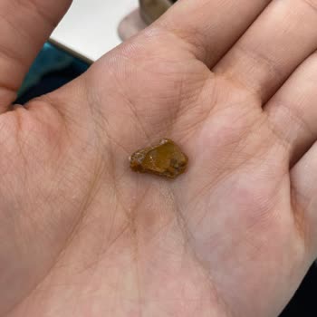 Granola İçindeki Badem Kabuğu Diş Tedavisi Geçiren Müşteriye Ağrı Ve Sağlık Tehlikesi Oluşturdu
