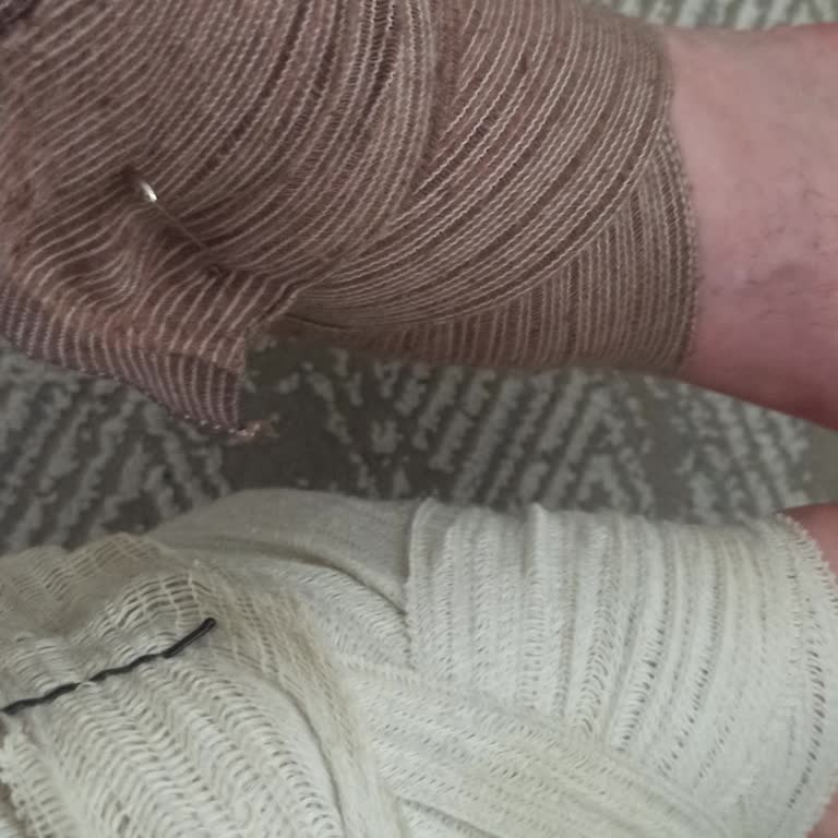 Acil Ayak Bileği Destek Ürünün Tesliminde Şok Gecikme Ve İletişimsizlik