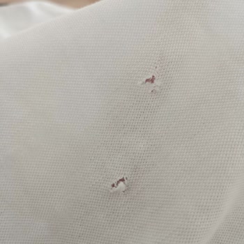 Tekrarlayan Çapak Sorunu Çamaşır Makinesinde Kıyafetleri Deliyor Ve Profilo'dan İade Talebi
