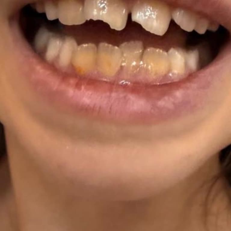 Uğur Okulları Bahçeşehir Şubesinde Çocuklara Yönelik Fiziksel Ve Psikolojik Şiddet Ve İhmal