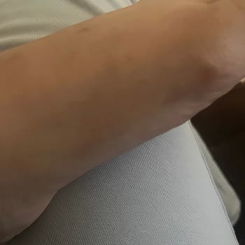 Ayak Yaralayan Stiletto Sandalet Ve Trendyol’da İade Sorunu