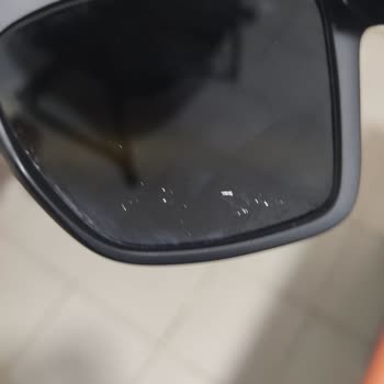 Tamir Sonrası Çatlak Lens Ve Gözlük Değişimindeki Uzun Gecikme