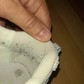 New Balance Ayakkabısında İç Tüylenme Ve Topaklanma Sorunu