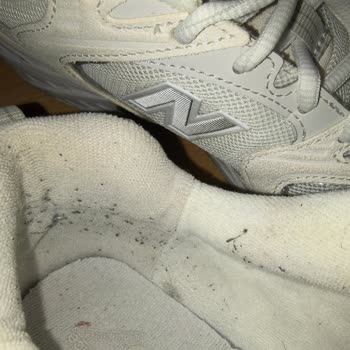 New Balance Ayakkabısında İç Tüylenme Ve Topaklanma Sorunu
