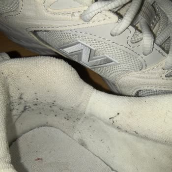 New Balance Ayakkabısında İç Tüylenme Ve Topaklanma Sorunu
