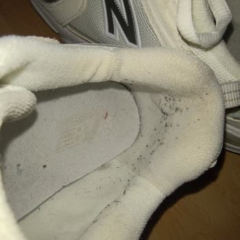 New Balance Ayakkabısında İç Tüylenme Ve Topaklanma Sorunu