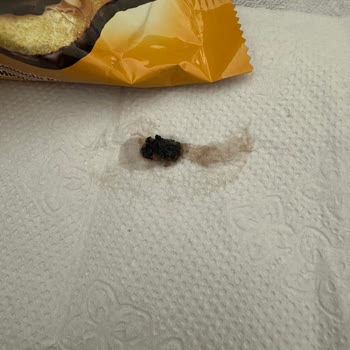 Ülker Muzlu Kekte Sert Siyah Parça Bulunması Sağlık Riski