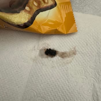 Ülker Muzlu Kekte Sert Siyah Parça Bulunması Sağlık Riski
