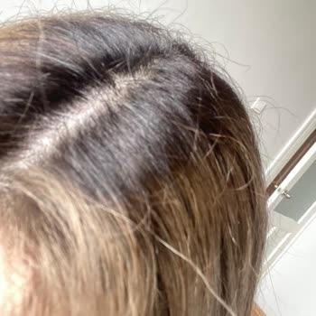 Saçlarım Turunculaştı Ve Koptu: No1 Coiffeur'da Kimyasal Zarar Ve Para Odaklı Mağduriyet