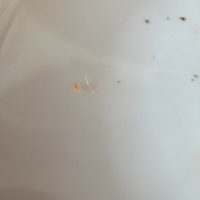 Migros Jet’te Satın Alınan California Roll’da Yabancı Katı Madde Ve Hijyen Sorunu