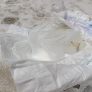 Bebek Bezinde İç Parça Ayrıldı Ve Üretim Hatası Mağduriyet Yaratıyor
