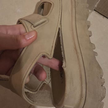 Ugg Sandaletimde Üretim Hatası İddiası Ve Şirketin Bakım Hatası Açıklaması