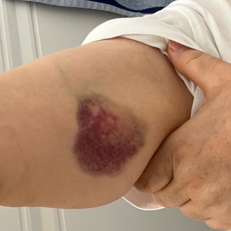 Mandalı Sabitlenmeyen Süpürge Annemi Yaraladı, Ürün Değişimi Talep Ediyorum