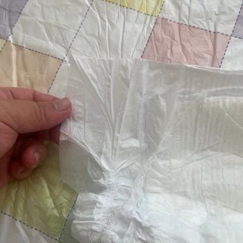 Molfix Bebek Bezlerinde İçerik Farklılığı Ve İade Reddi
