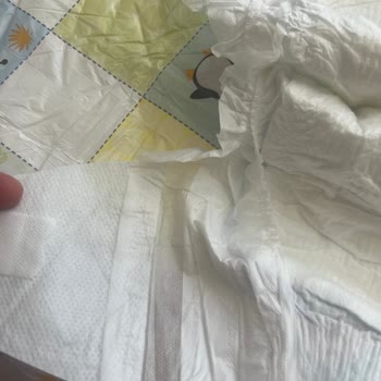 Molfix Bebek Bezlerinde İçerik Farklılığı Ve İade Reddi