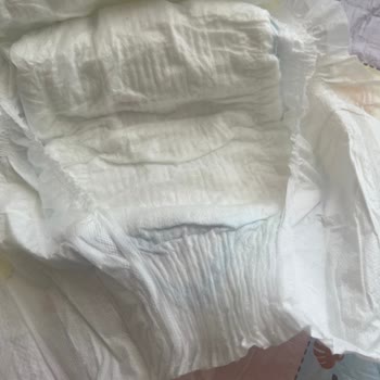 Molfix Bebek Bezlerinde İçerik Farklılığı Ve İade Reddi