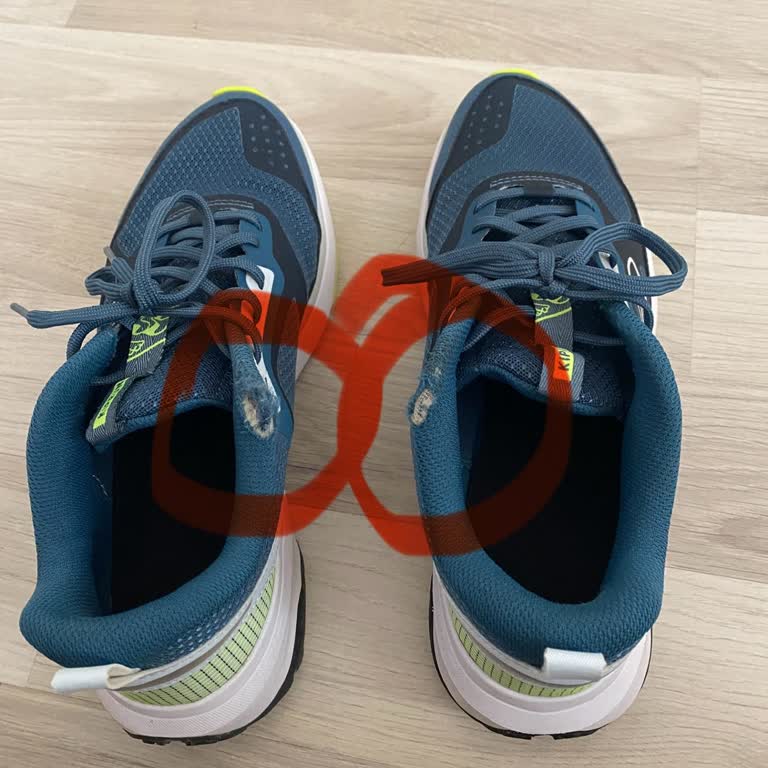 Decathlon Kalenji Ayakkabısında Kısa Sürede Bilek Bölgesinde Açılma Ve Garanti Dışı Reddi