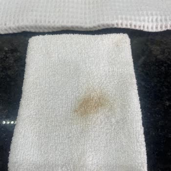 Dermojin Sözde Leke Avcısı