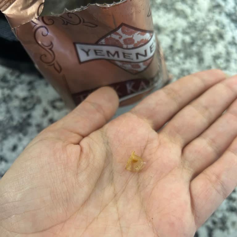 Şok Market Kahvesinde Poşet Parçası Bulunması Ve Sağlık Riski