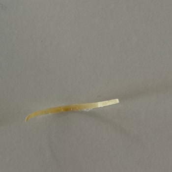 İnci Mantısında Plastiğe Benzer Yabancı Madde Ve Sağlık Endişesi