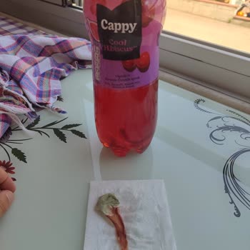 Cappy Şişesinde Küflü Yabancı Madde Ve Çocukları Tehdit Eden Hijyen Sorunu