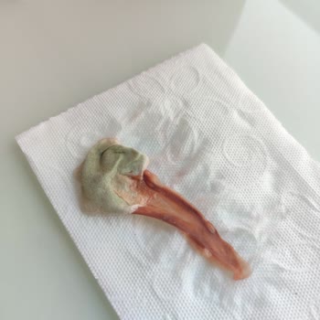 Cappy Şişesinde Küflü Yabancı Madde Ve Çocukları Tehdit Eden Hijyen Sorunu