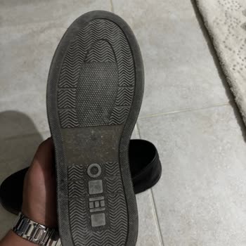 Ayakkabıda Deri Soyulması Ve Yanma Nedeniyle İade Talebi