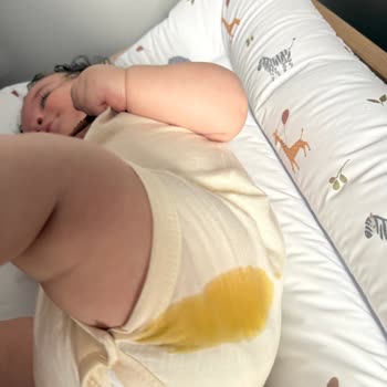 Prima Premium Care Bezlerinde Sürekli Kaka Taşması Ve Kıyafet Kirlenmesi