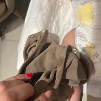 Prima Premium Care Bezlerinde Sürekli Kaka Taşması Ve Kıyafet Kirlenmesi