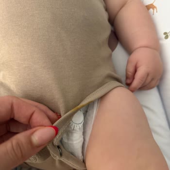Prima Premium Care Bezlerinde Sürekli Kaka Taşması Ve Kıyafet Kirlenmesi