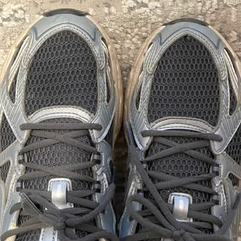 Skechers Ayakkabısının Dikiş Açması Ve İade Talebimin Reddedilmesi