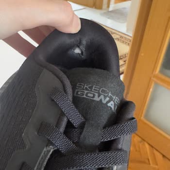 Skechers Ayakkabısında Erken Yırtılma Ve Mağazanın Kullanıcı Hatası İddiası