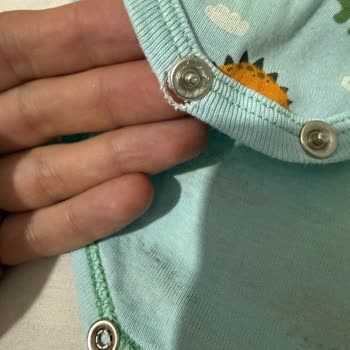 Atlet Zıbınlarının Metal Çıtçıtları Kırılması Ve Güvenlik Riski