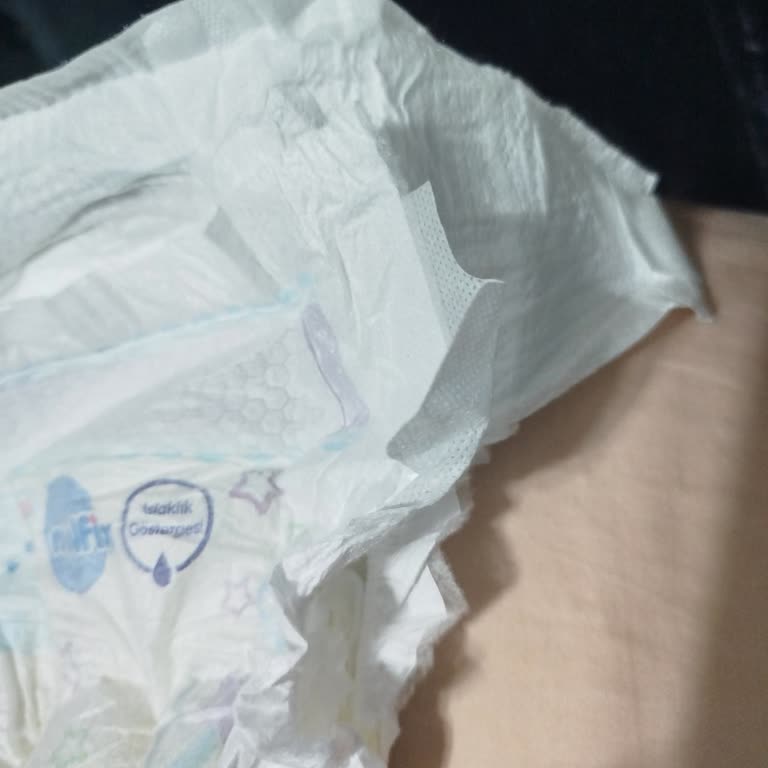 Molfix Bebek Bezi Sızdırma Sorunu Ve İade Talebi