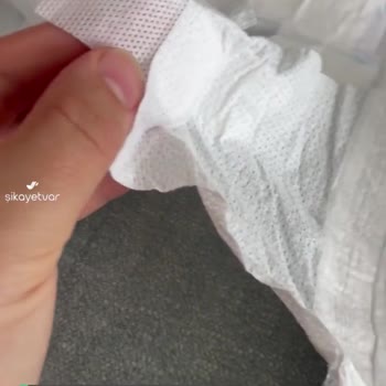Molfix Bebek Bezinin Kanatlarındaki Cırt Problemi (Eksik)