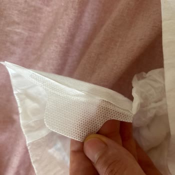 Molfix 5 Numaralı Bebek Bezinde Yapışkan Bantsız Ürün Sorunu