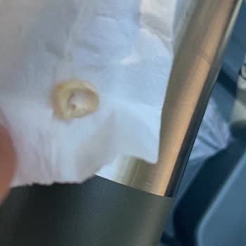Kaba Personel Davranışı Ve Acil Diş Tedavisi Gecikmesi Şikayeti