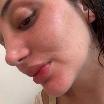 Uzun Süre Kullandığım La Roche Posay Güneş Kremi Koruma Sağlamadı, Yüzüm Yanıyor