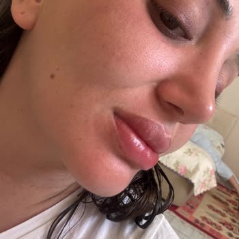 Uzun Süre Kullandığım La Roche Posay Güneş Kremi Koruma Sağlamadı, Yüzüm Yanıyor