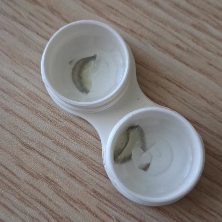 İmza Optik Lens Yırtıldı