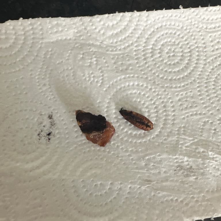 Bebek İçin Aldığım Hurmada Yabancı Madde Bulundu