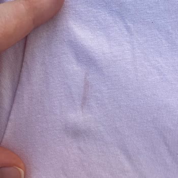 Beymen Çantasında Renk Atması Ve İade Talebi